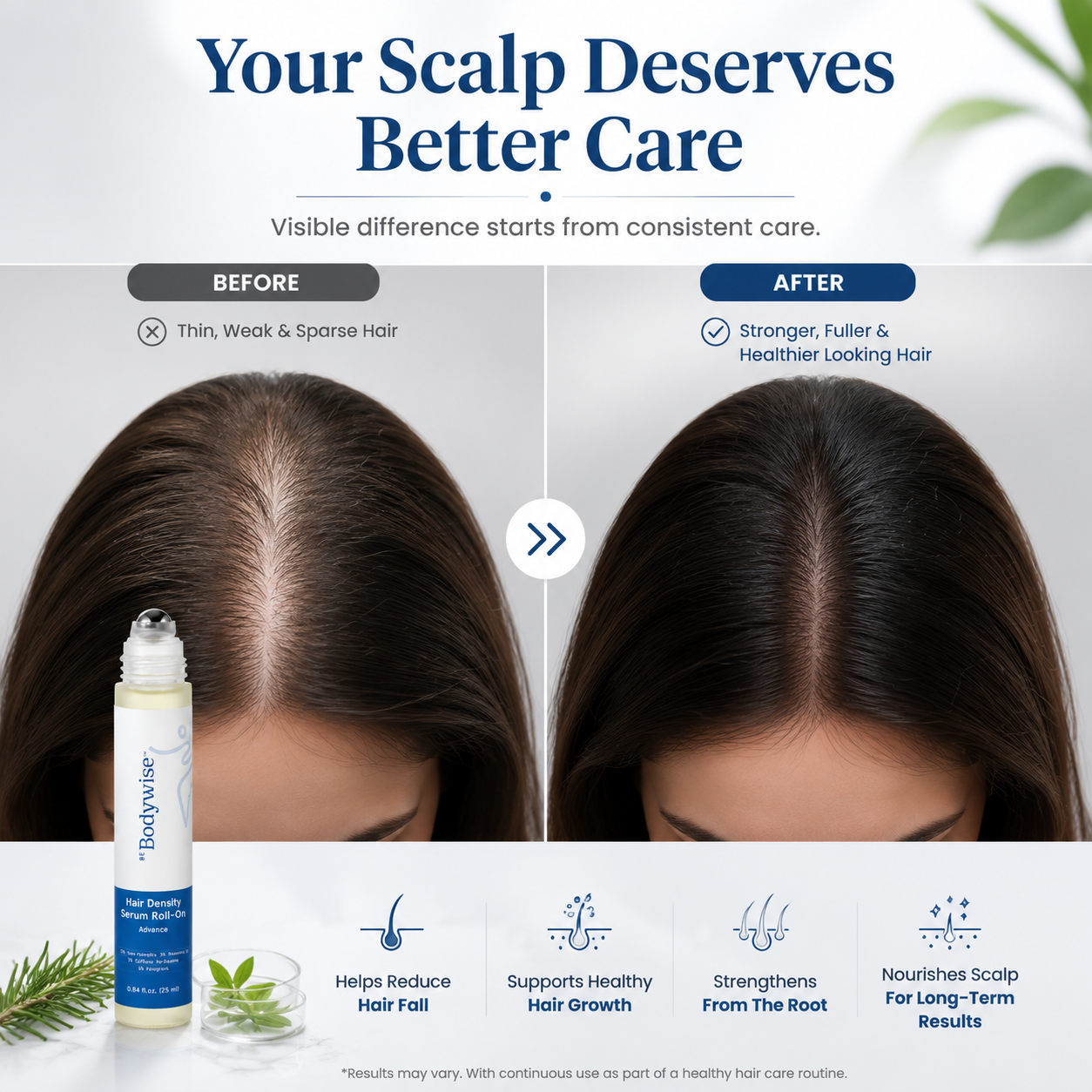 ✨ Advanced Hair Density Roll-On Serum – Scalp Care Treatment With Rosemary, Caffeine & Saw Palmetto For Thicker-Looking Hair