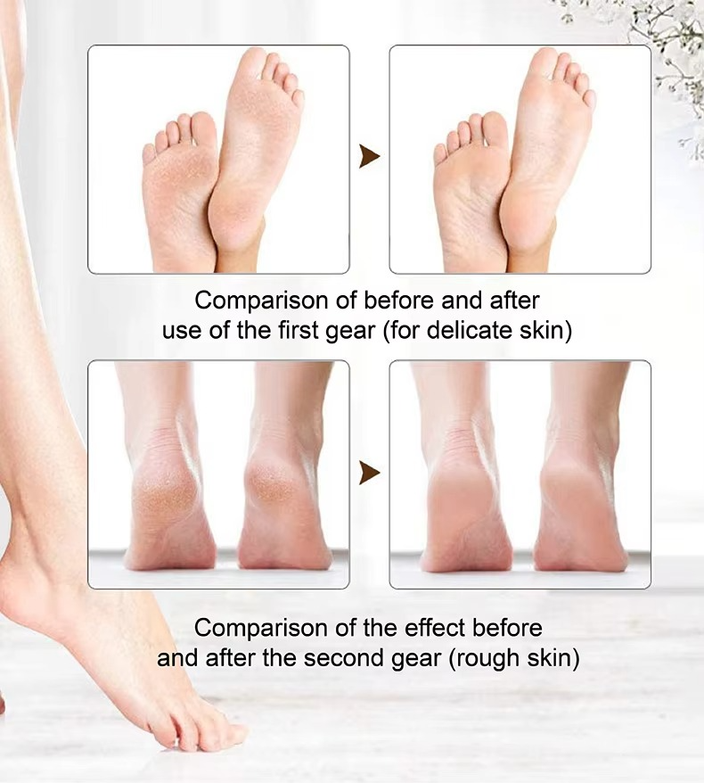 🔥Flash Sale: 50% OFF🎁Rechargeable Electric Foot File Callus Remover with LED Display