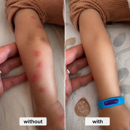 Bvuyomi™ Mosquito Bracelet