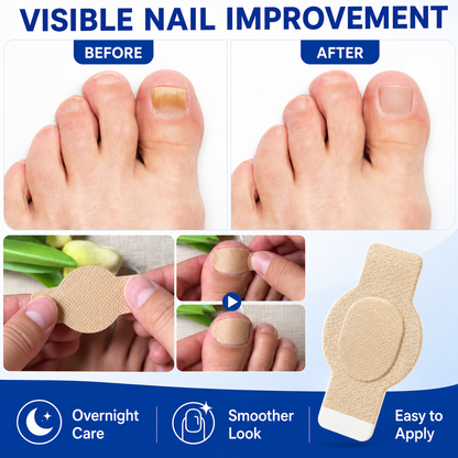 🔥Fungal Nail Patches, 21PCS Nail Repair Strips, Overnight Toenail Care