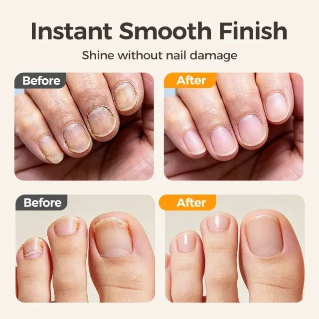 ⏳Time-Limited Special⏰2-in-1 Smart Electric Nail Trimmer & Polisher for All Ages