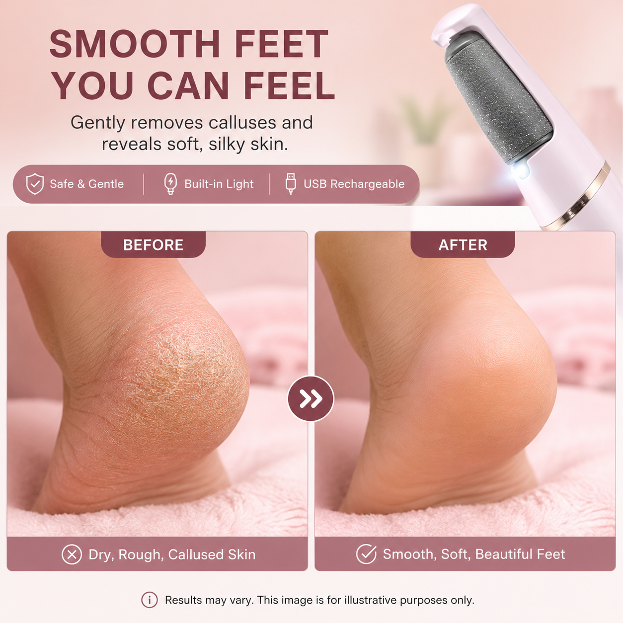 🔥Flash Sale: 50% OFF🎁Rechargeable Electric Foot File Callus Remover with LED Display